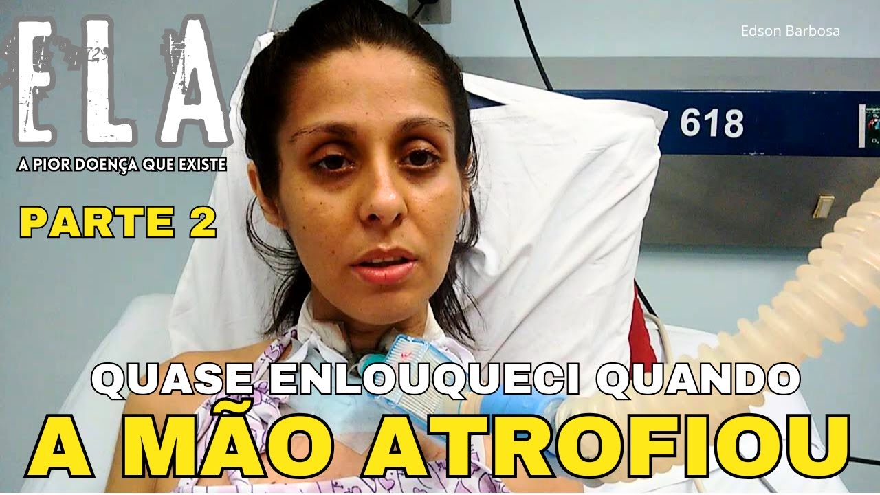 Quando vi a MÃO dela ATROFIADA fiquei DESESPERADO