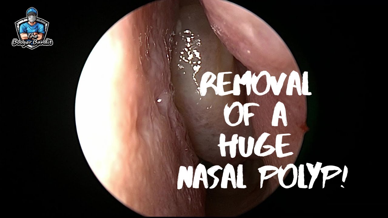 Blog Archives The Booger Bandit