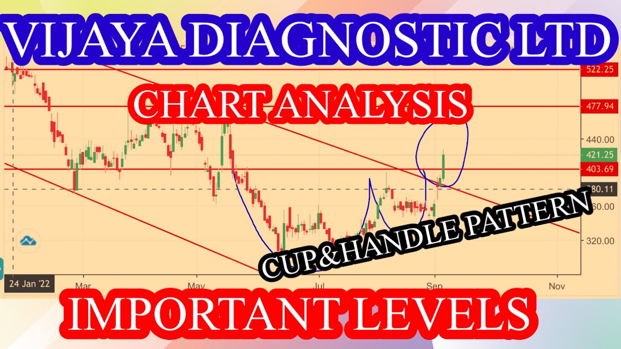 Vijaya diagnostic share latest news Vijaya diagnostic share news