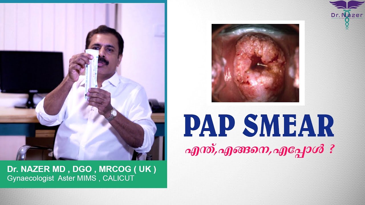 PAP SMEAR TEST | അറിഞ്ഞിരിക്കേണ്ട കാര്യങ്ങൾ| MALAYALAM | -  Dr.Nazer
