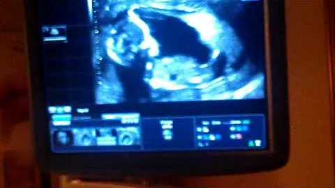 My first grand baby, Skylar Grace.