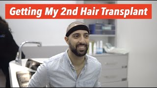 I GOT MY 2ND HAIR TRANSPLANT FROM TURKEY (FULL PROCESS) #veraclinic #hairtransplant #turkey