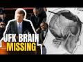 JFK's Brain Vanished From the National Archives