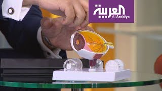 صباح العربية: شرح واضح لكيفية زرع عدسات العين