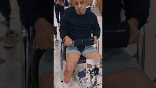 From Amputation to Freedom | Below Knee Prosthetic Leg Restores Cycling &amp; Walking Independence
