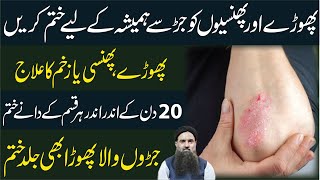 Phoray phunsi ka ilaj in urdu hindi | Skin Boils Treatment | phinsi ka ilaj urdu | Dr Sharafat Ali screenshot 4