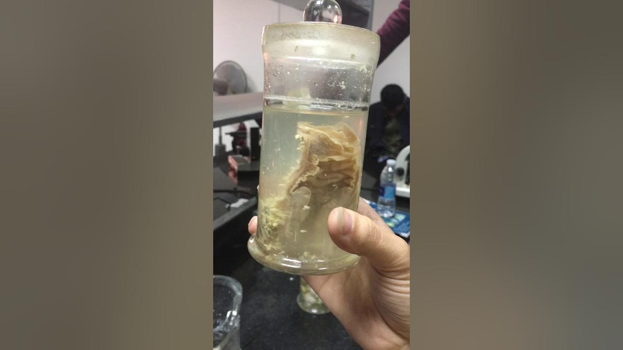 jars of pathology 3rd year (1st tirm) YouTube