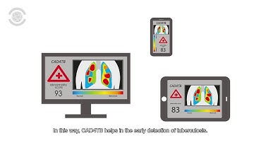 Delft Computer-Aided Detection for Tuberculosis (CAD4TB) box & cloud