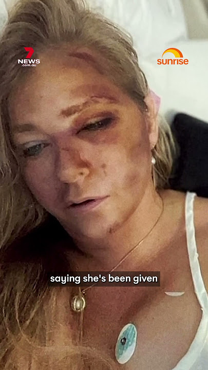 Epstein & Prince Andrew's accuser shares shocking health update