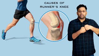 Runner's Knee: Causes, Symptoms, and Treatment | Expert Advice from Dr. Shriram Krishnamoorthy