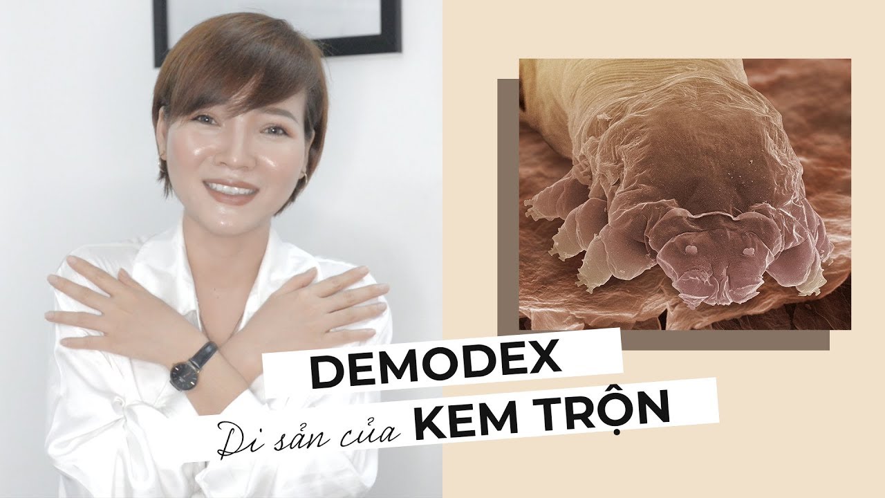 MỤN DO DEMODEX – DI SẢN KEM TRỘN & CÁCH ĐIỀU TRỊ | Tổng hợp những nội dung liên quan đến demodex là bệnh gì chi tiết nhất