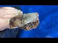 Ingrown toenails with onychomycosis, toenails have fungus black mud 1633