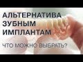 Чем заменить зубной имплант? Альтернатива имплантации зубов.