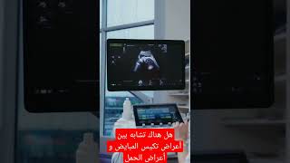 الفرق بين أعراض تكيس المبايض و أعراض الحمل صحة health الحمل رمضان أكل صحي