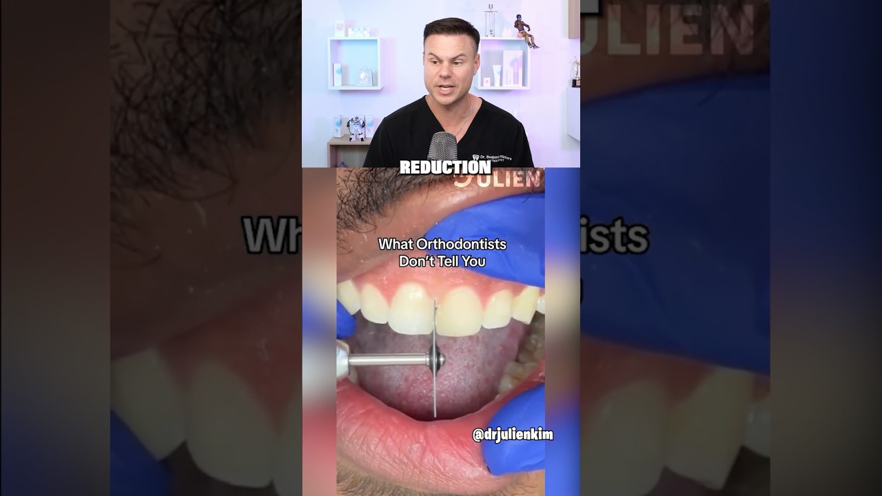 What Orthodontist DON’T Tell You! 😳🦷