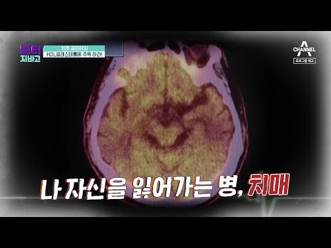 [예고] 치매 골든타임! &amp;#39;HDL콜레스테롤&amp;#39;을 주목하라!