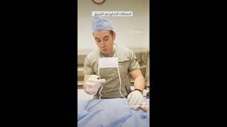 فك التصاقات الاصابع بعد حرق باستخدام رقعة جلدية/ أفضل طبيب تجميل مصر/ ا.د . صابر عبد المقصود