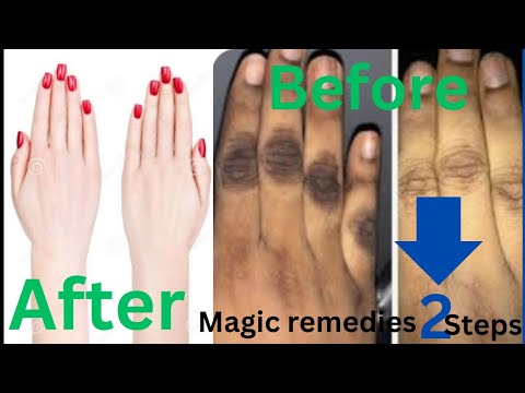 How to make your hands look 5 years younger overnight .self care tips ...