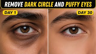 Remove Dark Circles Permanently with Simple Home Remedies at Home