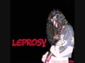 Leprosy - Cirrhosis