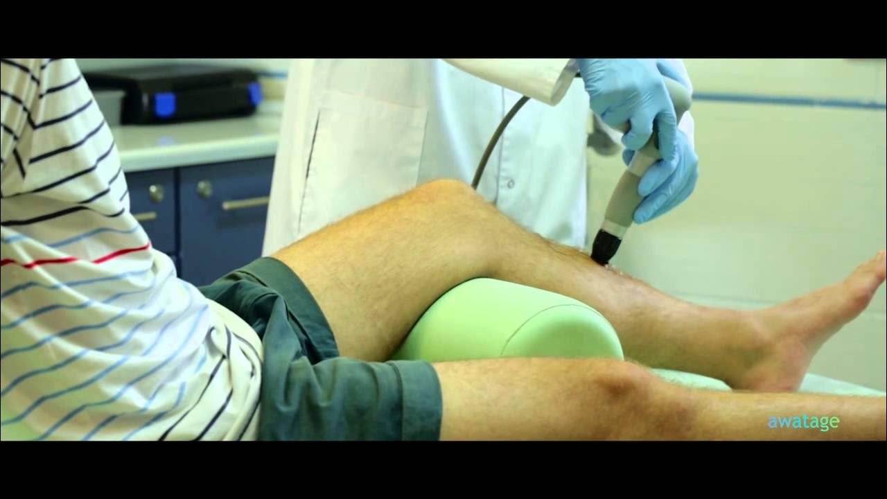 Почему не понравились шарику кальсоны пациента профессора. Ударно-волновая терапия при переломе голеностопа. Ударно волновая терапия ноги после перелома. Ударно-волновая терапия реклама. Лазерная терапия для сломанных костей.