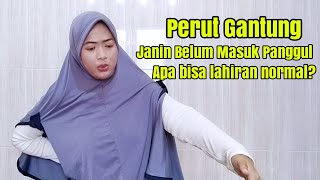 Perut Gantung Bisakah Melahirkan Normal?