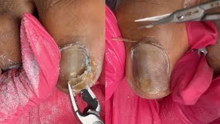 Nail Remover Gel Polish 7Mind Relaxing Ure