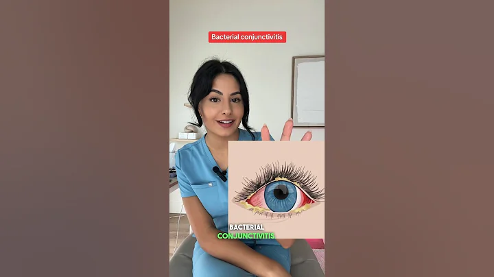 Doctor Explains why your eye is Red 👁️  🚨
