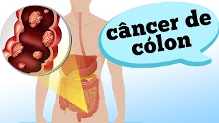 De intestino de sintomas ciática câncer