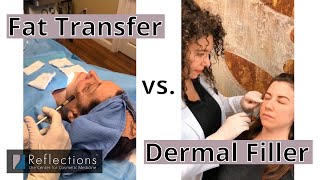 Fat Transfer vs Filler: Which is Right for You? A Plastic Surgeon Who Also Injects Fillers Weighs In