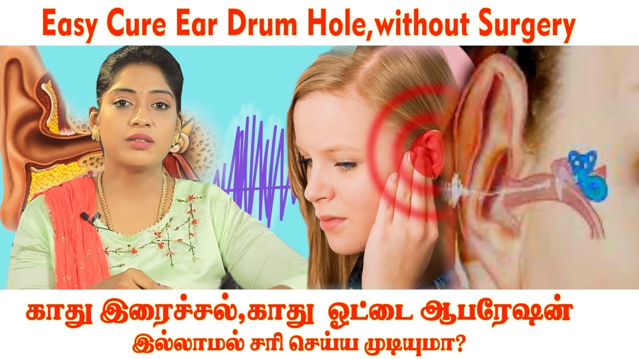 காது இரைச்சல்,காது  ஓட்டை ஆபரேஷன் இல்லாமல் சரி செய்ய முடியுமா? |