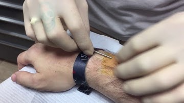 Needle & taper installation of xM1