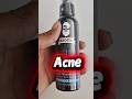 Muuchtac face wash| Remove Acne| Remove oilyskin #muuchstac #oilyskin#acneremoval #facewash#skincare