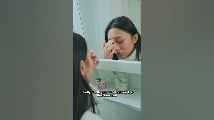 Melanoma of the scalp | Dr. Anna Chacon