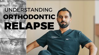 Orthodontic Relapse - What You Need to Know!