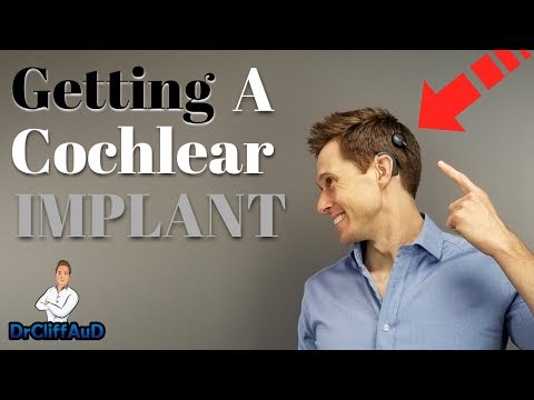 How To Get A Cochlear Implant | 3 Step Process