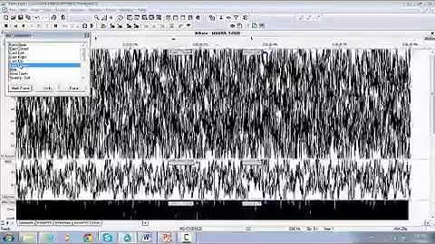 10. RemLogic Biocalibration Test e.g. Drive, S4500