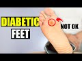 How To Take Care Of Diabetic Feet Avoid Neuropathy How To Take Care Of Diabetic Feet Avoid Neuropathy