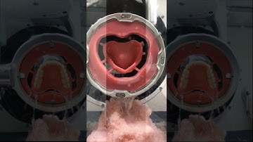 Digital meets Analog with BDS and Drake Dental Laboratory