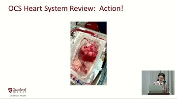TransMedics Heart Preservation System with Continuous Warm Blood Perfusion in the Pediatric Heart