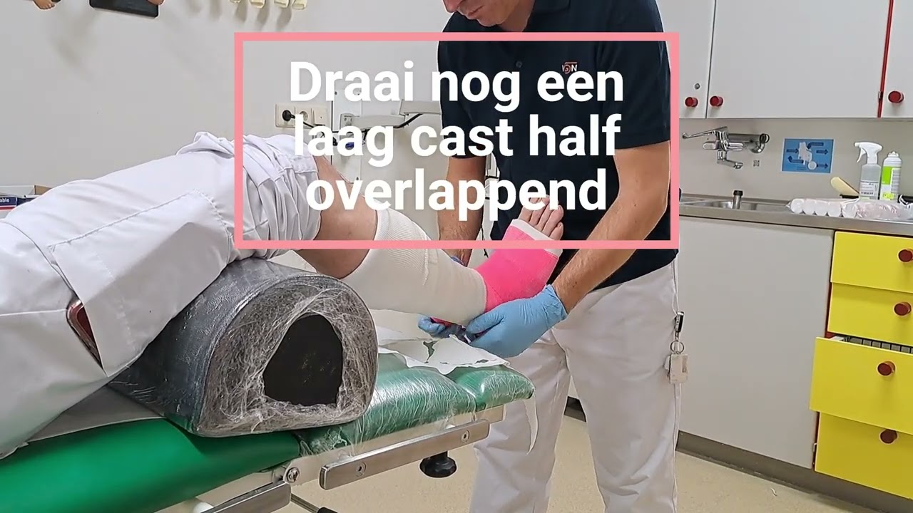 Onderbeen loopgips (cast)