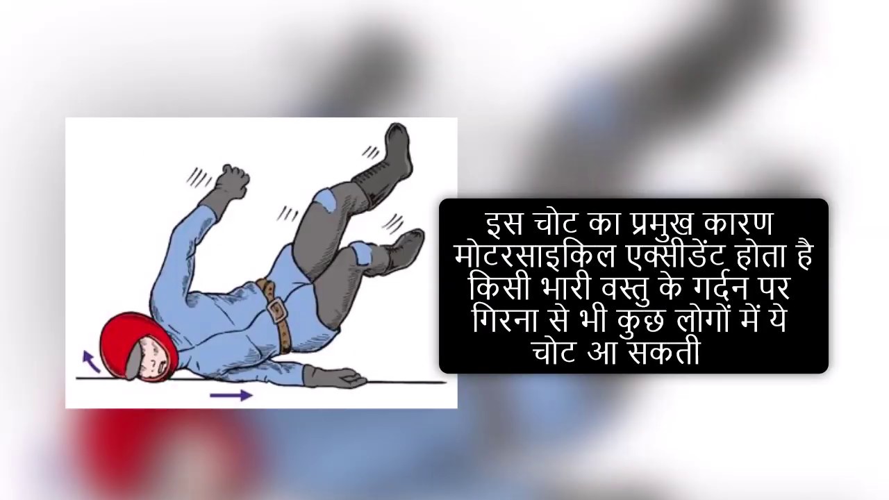 An awareness video for patients of brachial Plexus Injury