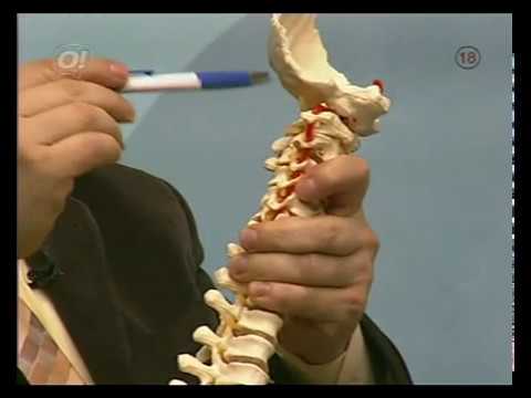 Video: Glavobolje S Osteokondrozo Vratne Kralježnice: Simptomi I Liječenje