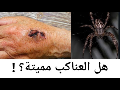 فيديو: ما العناكب السامة موجودة