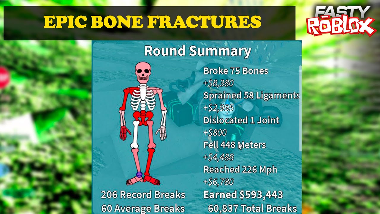Broken bones 4