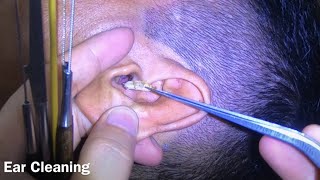 耳掃除 귀 청소 Ear Cleaning #300