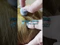 Anti-Dandruff Drops Treatment | ASMR Personal Attention | Scalp Sounds