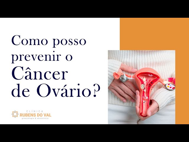 Sinto cólicas menstruais intensas. Pode ser Endometriose? - Clínica Rubens  do Val CRM 58764