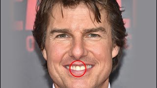 Tom Cruise world famous teeth have their own story to tell Does Tom Cruise Have Dentures