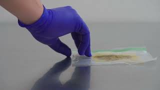 Cómo Enviar Una Muestra De Heces Correctamente?